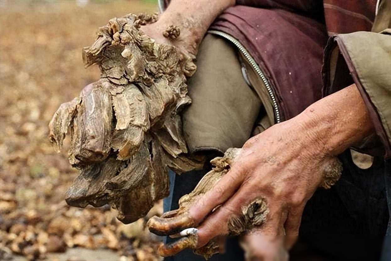 湖南男子四肢长满树枝，还能让树枝一夜开花，他是"树人"的转世
